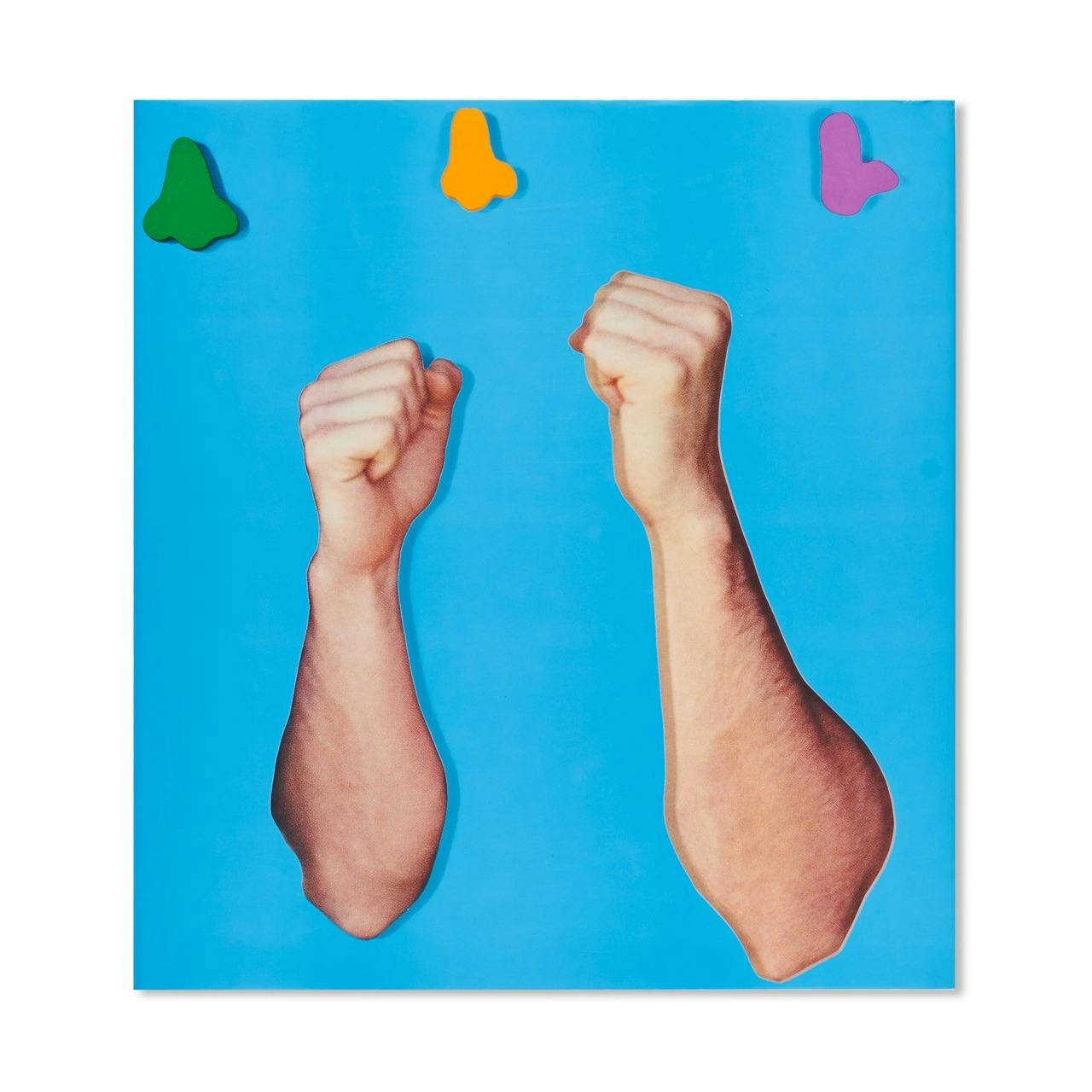 ARMS AND LEGS (SPECIF. ELBOWS & KNEES), ETC.