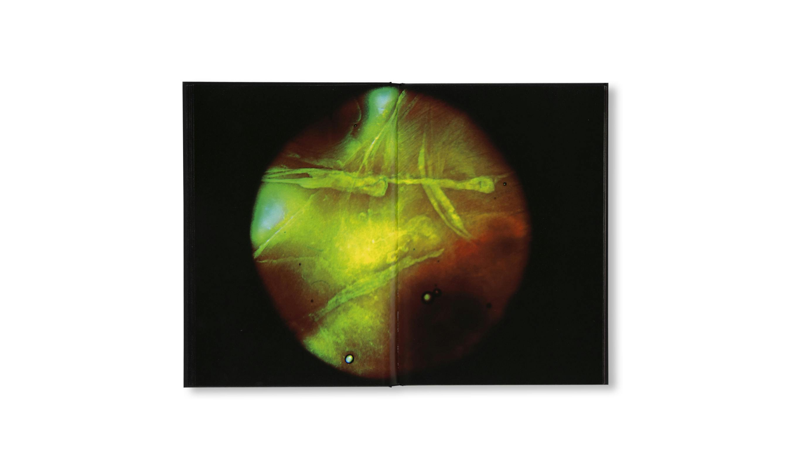 [予約受付中]  MY BLOODY HAND  [SIGNED]