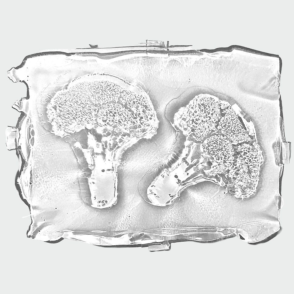 ブロッコリー II （specimenより）