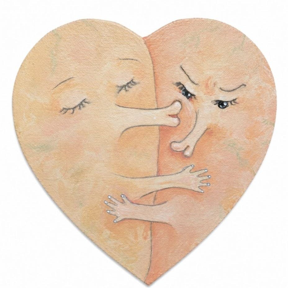 Kiss