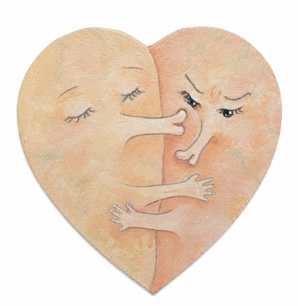Kiss